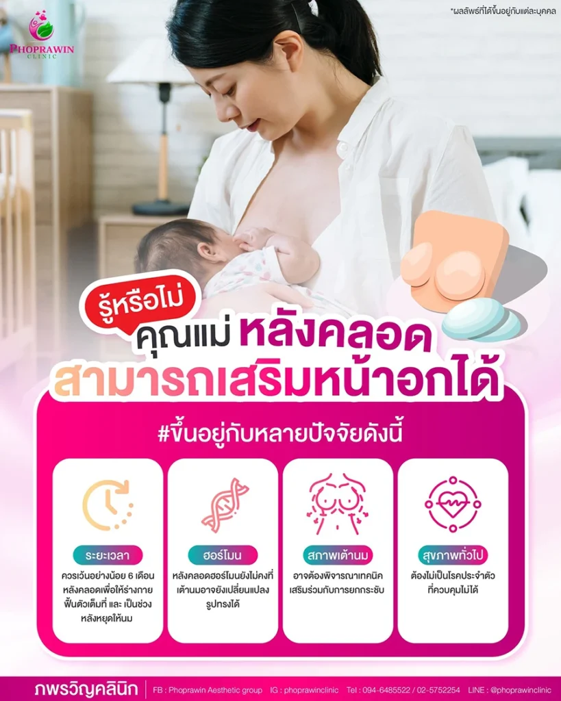 4 เรื่องที่คุณแม่หลังคลอดควรรู้ ก่อนตัดสินใจเสริมหน้าอก