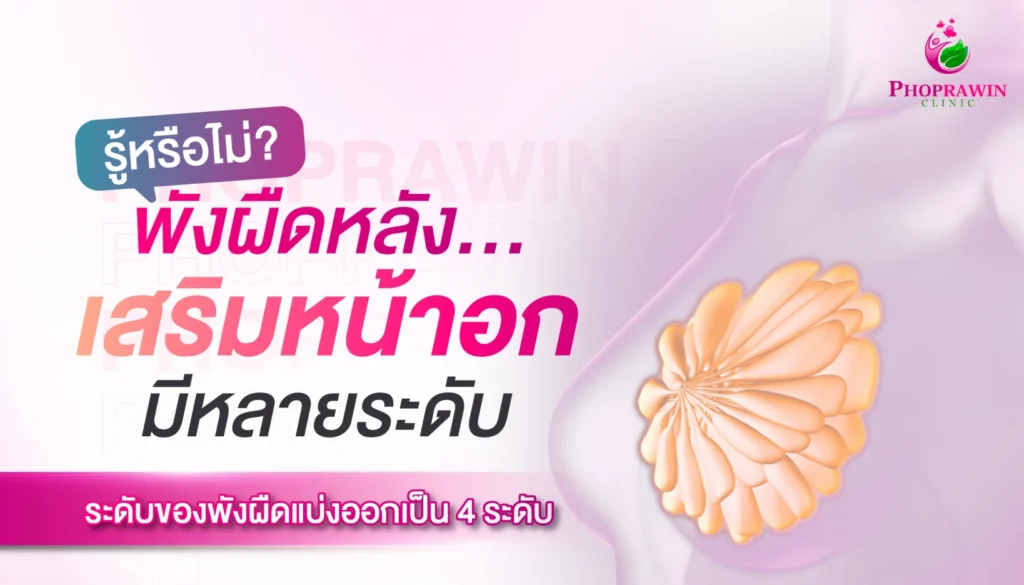 พังผืดหลังเสริมหน้าอกมี 4 ระดับ