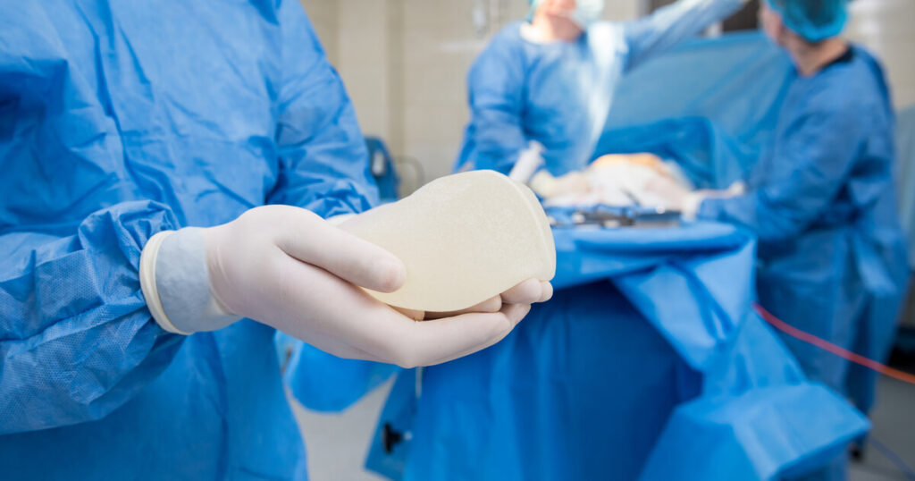 ซิลิโคน motiva ของประเทศอะไร