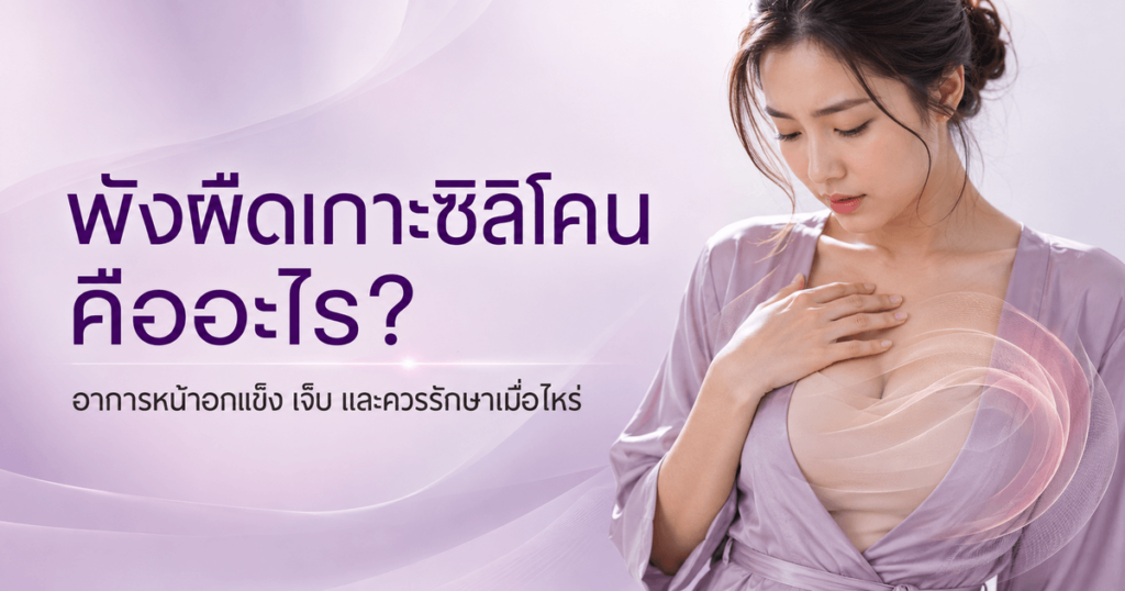 พังผืดเกาะซิลิโคน