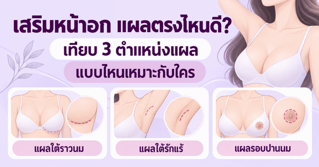 เสริมหน้าอก แผลตรงไหนดี