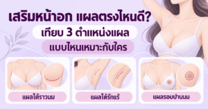 เสริมหน้าอก แผลตรงไหนดี